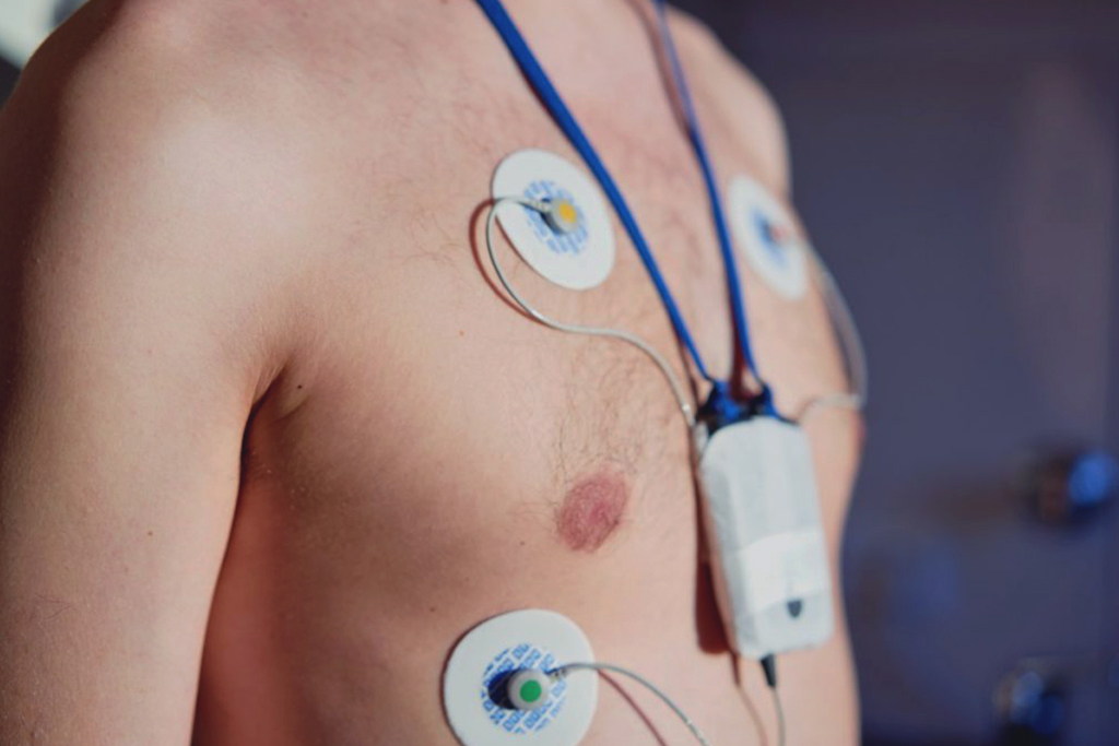 holter cardiaco come si svolge l'esame