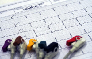 prevenzione cardiovascolare