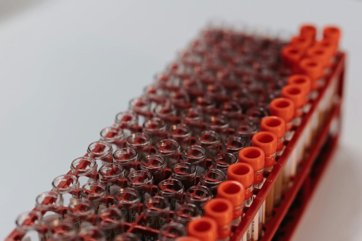 Analisi del sangue rapide a Torino